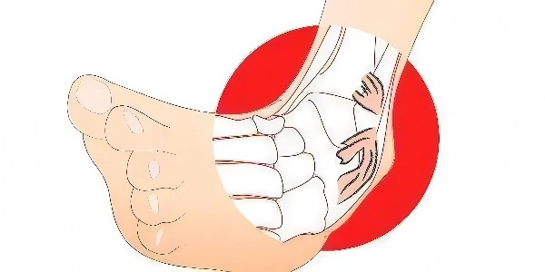 踝關(guān)節(jié)扭傷后的最佳應(yīng)對指南：簡單四步，助力快速康復(fù)！